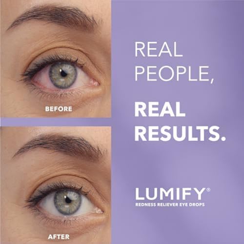 LUMIFY Redness Reliever Eye Drops 017 Fl Oz